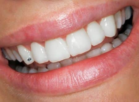 Boka tandundersökning hos Sturepraktiken, din tandläkare i Uppsala